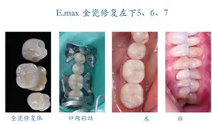 9游-剠?5{+Z&amp;磟;=^寽跾#y?o\(弜嵌洶鯫e鰱龅